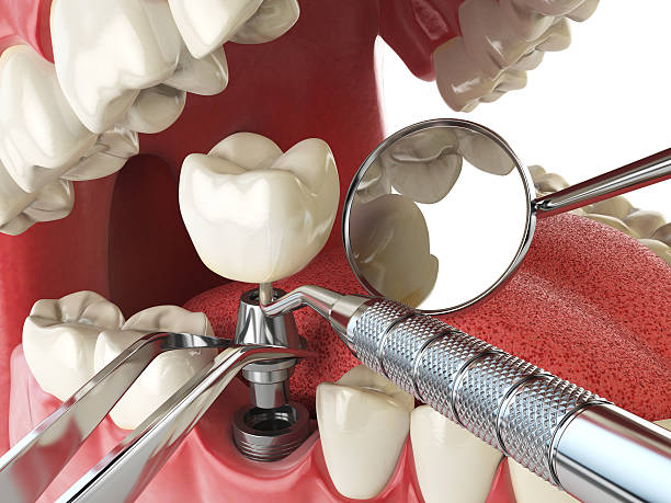 Best Emergency Dental Care for Broken or Chipped Teeth in South Floral Park, NY