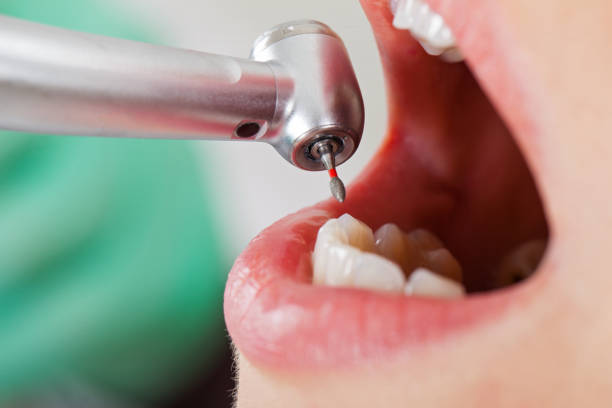 Best Emergency Treatment for Dental Infections or Abscesses in South Floral Park, NY